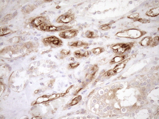 ASPDH Antibody - Immunohistochemical staining of paraffin-embedded Human Kidney tissue within the normal limits using anti-ASPDH mouse monoclonal antibody. (Heat-induced epitope retrieval by 1mM EDTA in 10mM Tris buffer. (pH8.5) at 120°C for 3 min. (1:150)