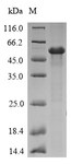 AFUA_2G03830 Protein - (Tris-Glycine gel) Discontinuous SDS-PAGE (reduced) with 5% enrichment gel and 15% separation gel.