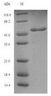 AFUA_4G09580 Protein - (Tris-Glycine gel) Discontinuous SDS-PAGE (reduced) with 5% enrichment gel and 15% separation gel.