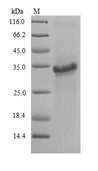 PRDX3 / Peroxiredoxin 3 Protein - (Tris-Glycine gel) Discontinuous SDS-PAGE (reduced) with 5% enrichment gel and 15% separation gel.