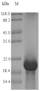 AFP Protein - (Tris-Glycine gel) Discontinuous SDS-PAGE (reduced) with 5% enrichment gel and 15% separation gel.