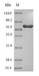 3-Phytase A Protein - (Tris-Glycine gel) Discontinuous SDS-PAGE (reduced) with 5% enrichment gel and 15% separation gel.