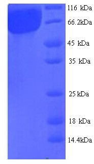 Alpha-Galactosidase B Protein