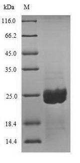 Aspergillopepsin-2 Protein - (Tris-Glycine gel) Discontinuous SDS-PAGE (reduced) with 5% enrichment gel and 15% separation gel.
