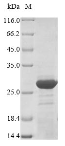 ret Protein - (Tris-Glycine gel) Discontinuous SDS-PAGE (reduced) with 5% enrichment gel and 15% separation gel.