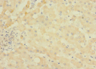 ASPHD1 Antibody - Immunohistochemistry of paraffin-embedded human liver tissue using ASPHD1 Antibody at dilution of 1:100