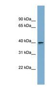 ASPHD2 Antibody - ASPHD2 antibody Western blot of MCF7 cell lysate. This image was taken for the unconjugated form of this product. Other forms have not been tested.