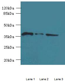ASPHD2 Antibody - Western blot. All lanes: ASPHD2 antibody at 4 ug/ml. Lane 1: HeLa whole cell lysate. Lane 2: MCF7 whole cell lysate. Lane 3: HL60 whole cell lysate. Secondary antibody: Goat polyclonal to Rabbit IgG at 1:10000 dilution. Predicted band size: 42 kDa. Observed band size: 42 kDa.