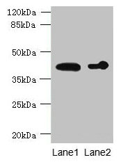 ASPHD2 Antibody - Western blot All lanes: ASPHD2 antibody at 4µg/ml Lane 1: Hela whole cell lysate Lane 2: MCF-7 whole cell lysate Lane 3: HL60 whole cell lysate Secondary Goat polyclonal to rabbit IgG at 1/10000 dilution Predicted band size: 42 kDa Observed band size: 42 kDa