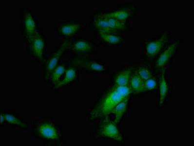 ASPM Antibody - Immunofluorescent analysis of Hela cells at a dilution of 1:100 and Alexa Fluor 488-congugated AffiniPure Goat Anti-Rabbit IgG(H+L)