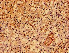 ASPM Antibody - Immunohistochemistry image of paraffin-embedded human adrenal gland tissue at a dilution of 1:100
