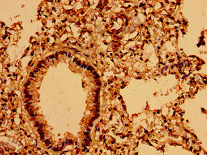 ASPM Antibody - Immunohistochemistry image of paraffin-embedded human lung tissue at a dilution of 1:100