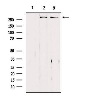ASPM Antibody - Western blot analysis of extracts of various samples using ASPM antibody. Lane 1: 293 treated with blocking peptide. Lane 2: 293; Lane 3: HeLa;