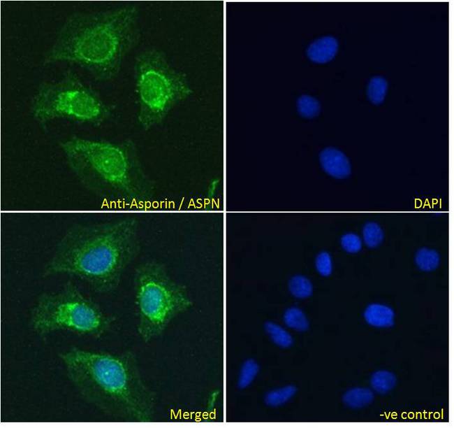 ASPN / Asporin Antibody - ASPN / Asporin antibody immunofluorescence analysis of paraformaldehyde fixed HeLa cells, permeabilized with 0.15% Triton. Primary incubation 1hr (10ug/ml) followed by Alexa Fluor 488 secondary antibody (4ug/ml), showing nuclear membrane staining. The nuclear stain is DAPI (blue). Negative control: Unimmunized goat IgG (10ug/ml) followed by Alexa Fluor 488 secondary antibody (2ug/ml).