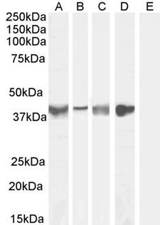 ASPN / Asporin Antibody - ASPN / Asporin antibody (0.1µg/ml) staining of Human Tonsil (A), (0.3ug/ml) Human Uterus (B), Mouse Skeletal Muscle (C) (1ug/ml) Rat Skeletal Muscle (D) and negative control Human Cerebellum (E) lysate (35µg protein in RIPA buffer).Detected by chemiluminescence.