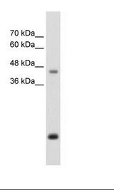 ASPN / Asporin Antibody - HepG2 Cell Lysate.  This image was taken for the unconjugated form of this product. Other forms have not been tested.