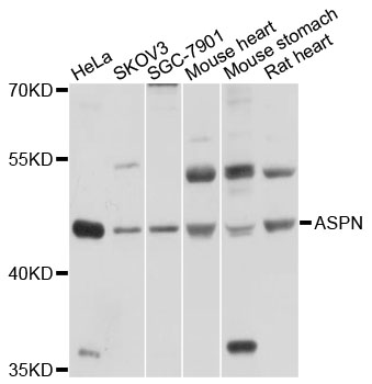 ASPN / Asporin Antibody - Western blot analysis of extracts of various cell lines, using ASPN antibody at 1:1000 dilution. The secondary antibody used was an HRP Goat Anti-Rabbit IgG (H+L) at 1:10000 dilution. Lysates were loaded 25ug per lane and 3% nonfat dry milk in TBST was used for blocking. An ECL Kit was used for detection and the exposure time was 10s.