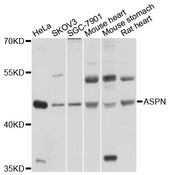 ASPN / Asporin Antibody - Western blot analysis of extracts of various cell lines, using ASPN antibody at 1:1000 dilution. The secondary antibody used was an HRP Goat Anti-Rabbit IgG (H+L) at 1:10000 dilution. Lysates were loaded 25ug per lane and 3% nonfat dry milk in TBST was used for blocking. An ECL Kit was used for detection and the exposure time was 10s.