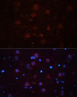 ASPN / Asporin Antibody - Immunofluorescence analysis of Rat brain using ASPN Polyclonal Antibody at dilution of 1:100 (40x lens).Blue: DAPI for nuclear staining.
