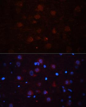 ASPN / Asporin Antibody - Immunofluorescence analysis of Rat brain using ASPN Polyclonal Antibody at dilution of 1:100 (40x lens).Blue: DAPI for nuclear staining.