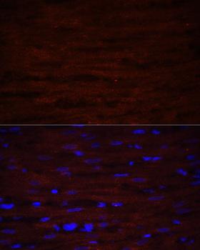 ASPN / Asporin Antibody - Immunofluorescence analysis of Rat heart using ASPN Polyclonal Antibody at dilution of 1:100 (40x lens).Blue: DAPI for nuclear staining.