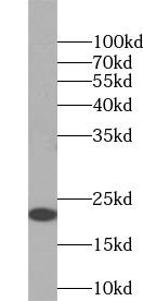 Asprosin Antibody - Recombinant proteins were subjected to SDS PAGE followed by western blot with asprosin antibody at dilution of 1:1000