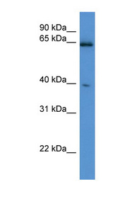 ASRGL1 Antibody - ASRGL1 antibody Western blot of Mouse Brain lysate. This image was taken for the unconjugated form of this product. Other forms have not been tested.