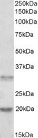 ASRGL1 Antibody - Goat Anti-ASRGL1 / ALP Antibody (0.5µg/ml) staining of Human Tonsil lysate (35µg protein in RIPA buffer). Primary incubation was 1 hour. Detected by chemiluminescencence.