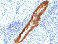 ASRGL1 Antibody - IHC testing of FFPE human endometrium with ASRGL1 antibody (clone CRASH/1289). Required HIER: steam sections in 10mM Tris with 1mM EDTA, pH9, for 10-20 min.