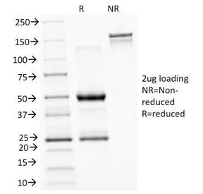 ASRGL1 Antibody - SDS-PAGE Analysis of Purified, BSA-Free ASRGL1 Antibody (clone CRASH/1289). Confirmation of Integrity and Purity of the Antibody.