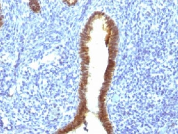 ASRGL1 Antibody - IHC testing of FFPE human uterus with ASRGL1 antibody (clone CRASH/1289). Required HIER: steam sections in 10mM Tris with 1mM EDTA, pH9, for 10-20 min.