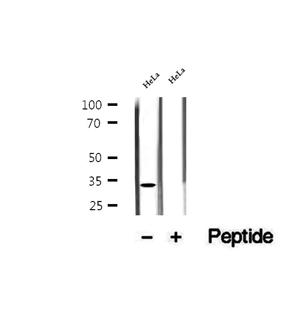 ASRGL1 Antibody - Western blot analysis of extracts of HeLa cells using ASRGL1 antibody.