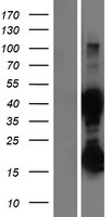 ASRGL1 Protein - Western validation with an anti-DDK antibody * L: Control HEK293 lysate R: Over-expression lysate