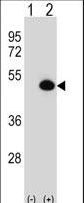 ASS1 / ASS Antibody - Western blot of ASS1 (arrow) using rabbit polyclonal ASS1 Antibody. 293 cell lysates (2 ug/lane) either nontransfected (Lane 1) or transiently transfected (Lane 2) with the ASS1 gene.