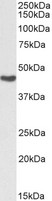 ASS1 / ASS Antibody - Biotinylated Goat Anti-Argininosuccinate synthetase 1 Antibody (0.03µg/ml) staining of Human Kidney lysate (35µg protein in RIPA buffer), exactly mirroring its parental non-biotinylated product. Primary incubation was 1 hour. Detected by chemiluminescencence, using streptavidin-HRP and using NAP blocker as a substitute for skimmed milk.