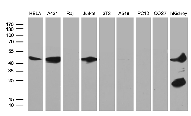 ASS1 / ASS Antibody - Western blot analysis of extracts. (35ug) from 8 different cell lines and human kidney tissue lysate by using anti-ASS1 monoclonal antibody. (1:500)