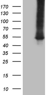 ASS1 / ASS Antibody - HEK293T cells were transfected with the pCMV6-ENTRY control. (Left lane) or pCMV6-ENTRY ASS1. (Right lane) cDNA for 48 hrs and lysed