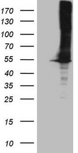 ASS1 / ASS Antibody - HEK293T cells were transfected with the pCMV6-ENTRY control. (Left lane) or pCMV6-ENTRY ASS1. (Right lane) cDNA for 48 hrs and lysed. Equivalent amounts of cell lysates. (5 ug per lane) were separated by SDS-PAGE and immunoblotted with anti-ASS1. (1:2000)