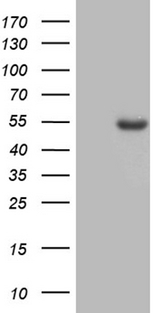 ASS1 / ASS Antibody - HEK293T cells were transfected with the pCMV6-ENTRY control. (Left lane) or pCMV6-ENTRY ASS1. (Right lane) cDNA for 48 hrs and lysed