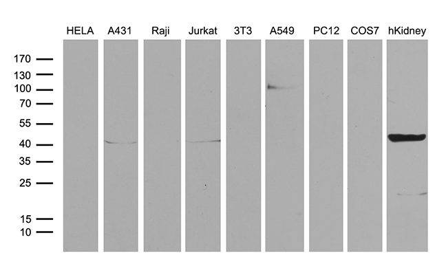 ASS1 / ASS Antibody - Western blot analysis of extracts. (35ug) from 8 different cell lines and human kidney tissue lysate by using anti-ASS1 monoclonal antibody. (1:500)