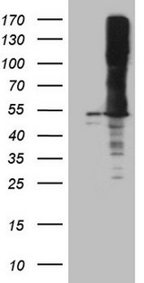 ASS1 / ASS Antibody - HEK293T cells were transfected with the pCMV6-ENTRY control. (Left lane) or pCMV6-ENTRY ASS1. (Right lane) cDNA for 48 hrs and lysed