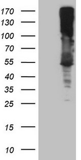 ASS1 / ASS Antibody - HEK293T cells were transfected with the pCMV6-ENTRY control. (Left lane) or pCMV6-ENTRY ASS1. (Right lane) cDNA for 48 hrs and lysed. Equivalent amounts of cell lysates. (5 ug per lane) were separated by SDS-PAGE and immunoblotted with anti-ASS1. (1:2000)