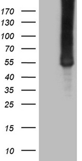 ASS1 / ASS Antibody - HEK293T cells were transfected with the pCMV6-ENTRY control. (Left lane) or pCMV6-ENTRY ASS1. (Right lane) cDNA for 48 hrs and lysed. Equivalent amounts of cell lysates. (5 ug per lane) were separated by SDS-PAGE and immunoblotted with anti-ASS1. (1:2000)