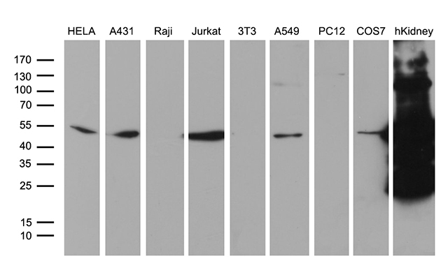 ASS1 / ASS Antibody - Western blot analysis of extracts. (35ug) from 8 different cell lines and human kidney tissue lysate by using anti-ASS1 monoclonal antibody. (1:500)