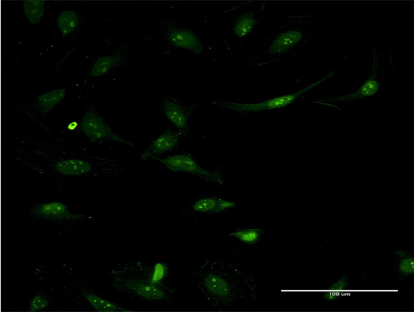 ASS1 / ASS Antibody - Immunofluorescence of monoclonal antibody to ASS1 on HeLa cell . [antibody concentration 10 ug/ml]