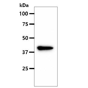 ASS1 / ASS Antibody - The MCF-7 cell lysate (40ug) were resolved by SDS-PAGE, transferred to PVDF membrane and probed with anti-human ASS1 antibody (1:500). Proteins were visualized using a goat anti-mouse secondary antibody conjugated to HRP and an ECL detection system.