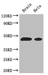 ASS1 / ASS Antibody - Positive WB detected in:Mouse brain tissue,Hela whole cell lysate;All lanes: ASS1 antibody at 3ug/ml;Secondary;Goat polyclonal to rabbit IgG at 1/50000 dilution;Predicted band size: 47 kDa;Observed band size: 47 kDa;