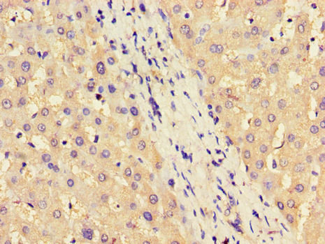 ASS1 / ASS Antibody - Immunohistochemistry of paraffin-embedded human liver tissue using ASS1 Antibody at dilution of 1:100