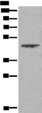 ASS1 / ASS Antibody - Western blot analysis of A431 cell lysate  using ASS1 Polyclonal Antibody at dilution of 1:350
