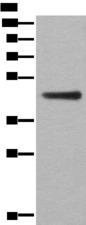 ASS1 / ASS Antibody - Western blot analysis of A431 cell lysate  using ASS1 Polyclonal Antibody at dilution of 1:300